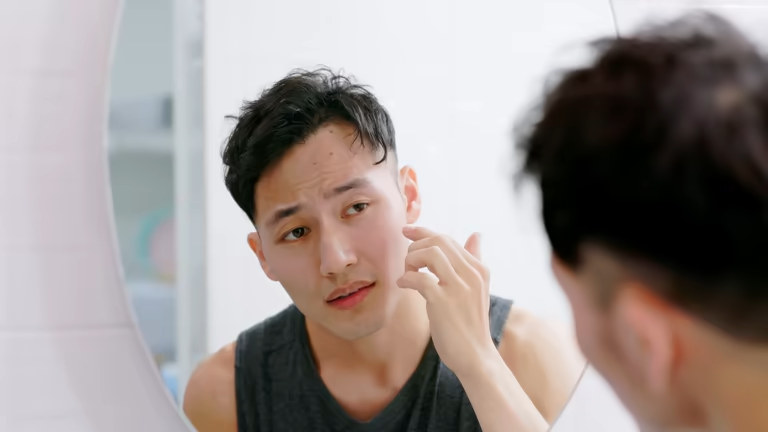 Man Skin Problems