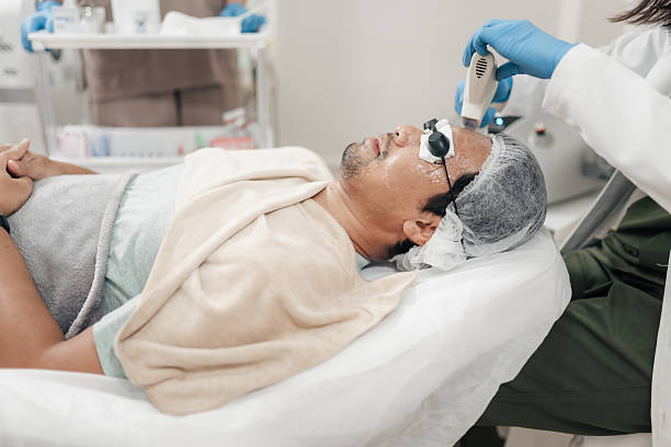Pigmentation Removal Treatment for stubborn sun damage in men